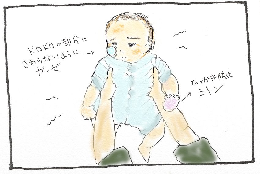 生後6か月頃